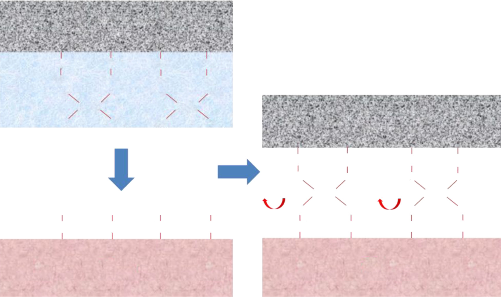 HEMOPATCH止血密封剂评估-CSDN博客